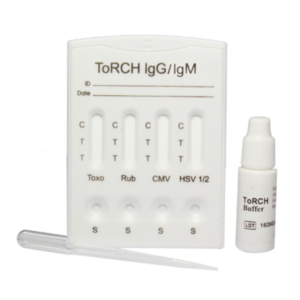 Prueba de ToRCH IgG/IgM